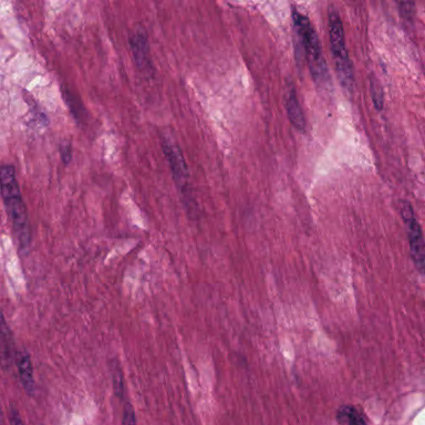 A 96-micrometer comparison region with lower predicted neutrophil and malignant-cell content on the same slide