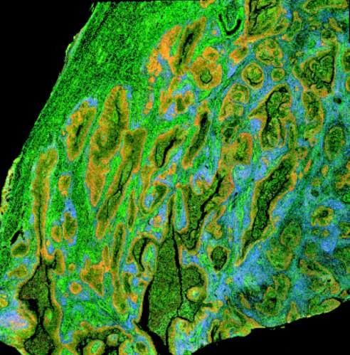 Cell composition predicted from the H&E
