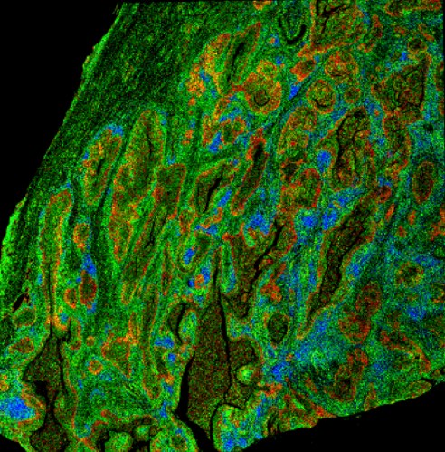 Reference cell composition from MiraTyper cell labels