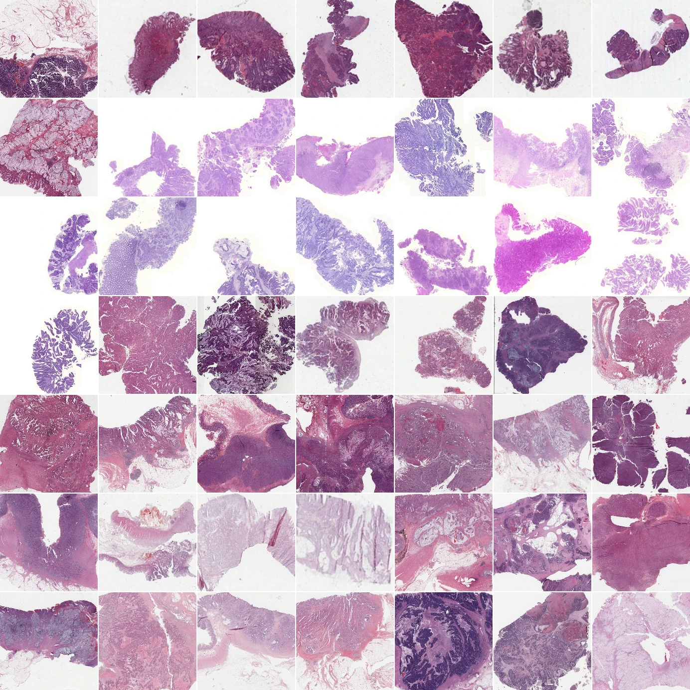 A 7 by 7 grid of H&E-stained tissue regions from 49 TCGA colon cancer slides
