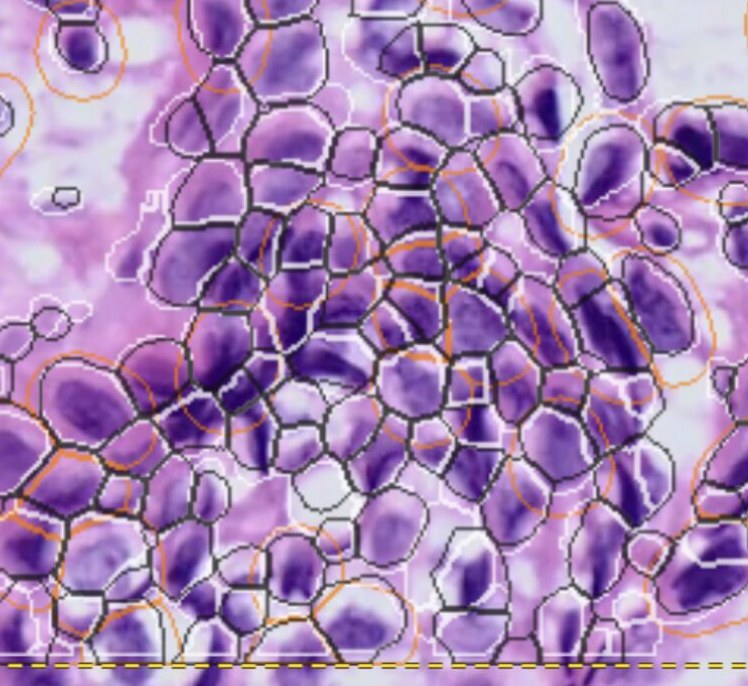 Cell boundaries drawn over a Visium HD H&E image, separating individual nuclei
